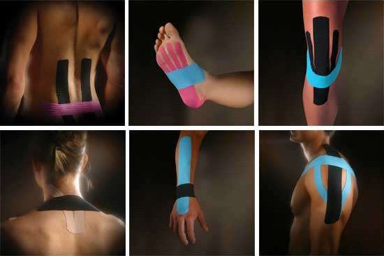 kinesiotaping